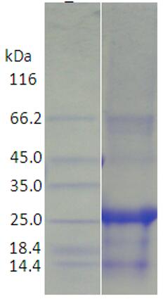 15% SDS-PAGE analysis profiles of purified KP1_1632-23-275 (CBB stained).
